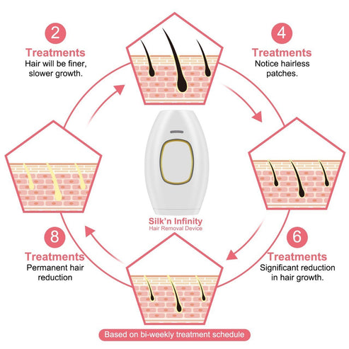 IPL Laser Hair Removal Device – Handheld & Painless Beauty Apparatus